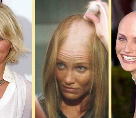 18 актрис, які заради ролі позбулися свого красивого волосся (спойлер: серед них є і наші зірки)