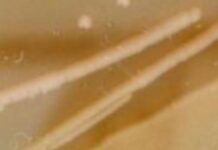 Стародавні Бактерії Зберігають Ключі до Сучасної Стійкості до Антибіотиків