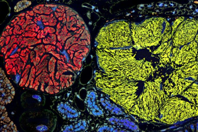 bfa1e37b-53f6-4a21-84f6-c91e66cc4393